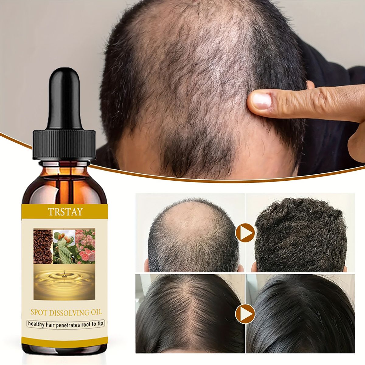 Beard Oil Growth - 50Ml Baard Groei Olie Anti Alopecia
