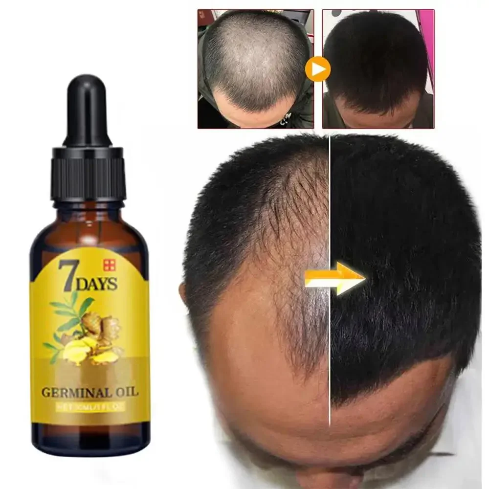 Beard Oil Growth - Haargroei Gember Snelgroeiend haar Essentiële olie