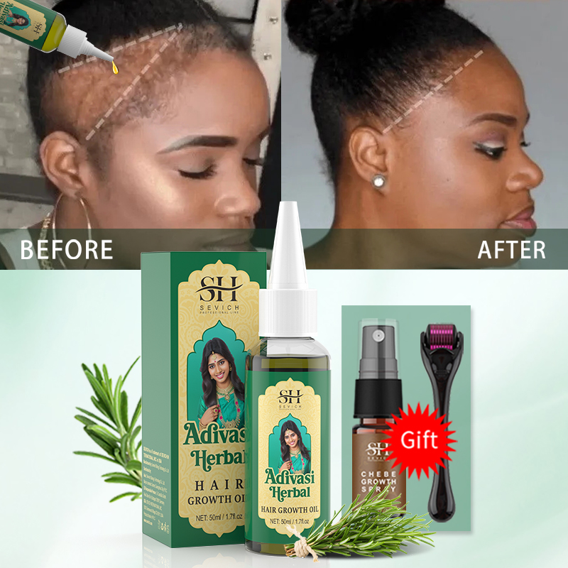 Ayurvedische haargroeiolie Ind - Beard Oil Growth recensie en prijs