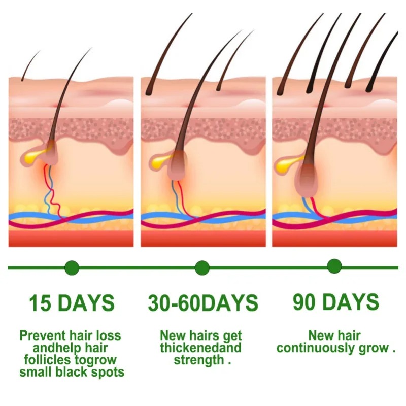 Haargroei Serum Snelgroeiende  - Beard Oil Growth recensie en prijs