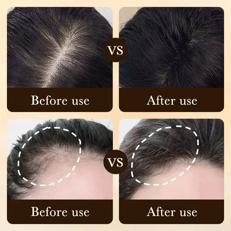 Biotine Snelle Haargroei Oliep - Beard Oil Growth recensie en prijs