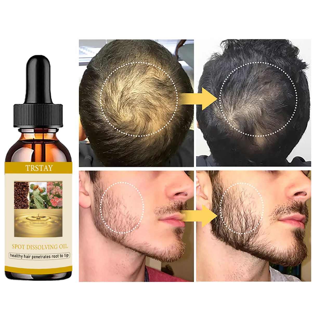 50Ml Baard Groei Olie Anti Alo - Beard Oil Growth recensie en prijs