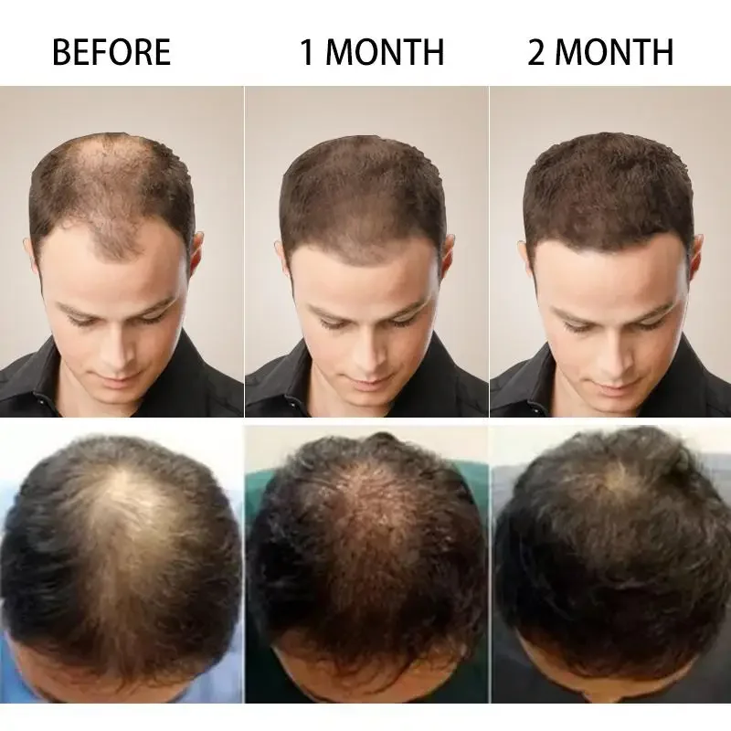 Haargroei Gember Snelgroeiend  - Beard Oil Growth recensie en prijs