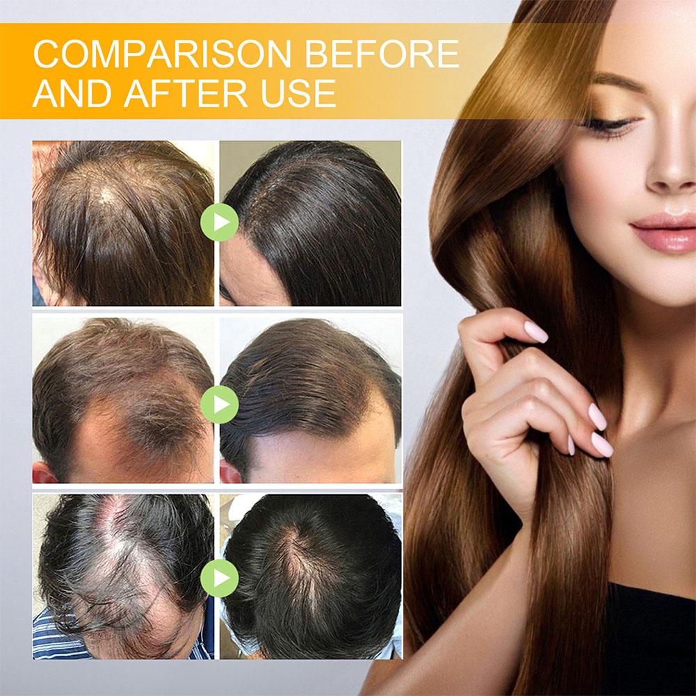 5/3/1pcs Biotine Snelle Haargr - Beard Oil Growth recensie en prijs